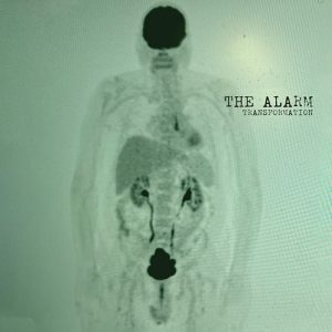 THE ALARM Put Out Mike Peters’s Final Album
